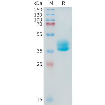 Human B7-H7(223-344) Protein, hFc Tag