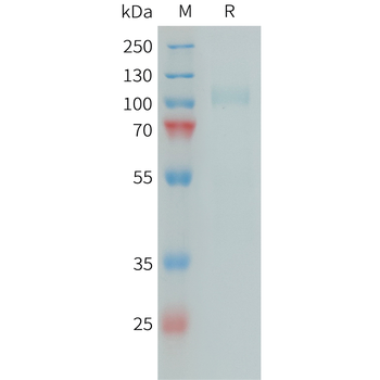 Human CD117(113-211) Protein, hFc Tag