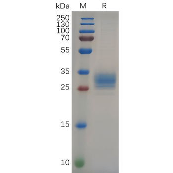 Human CD27 Protein, mFc-His Tag