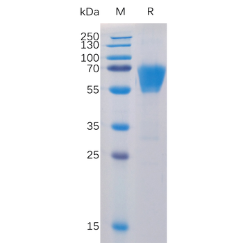 Human OX40 Protein, hFc-His tag