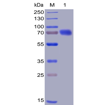 Human PD-L1 Protein, mFc-His tag