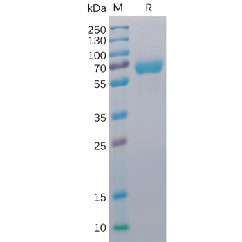 Human PD-1 Protein, mFc-His tag