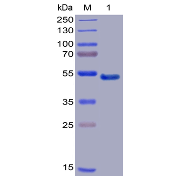 Human CD96 Protein, mFc-His tag