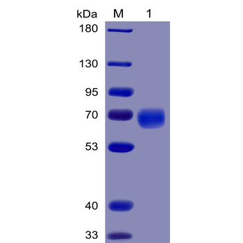 Human Mesothelin (296-580) Protein, mFc-His Tag