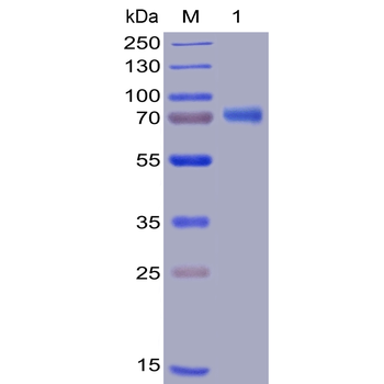 Human IL6 Protein, mFc-His Tag