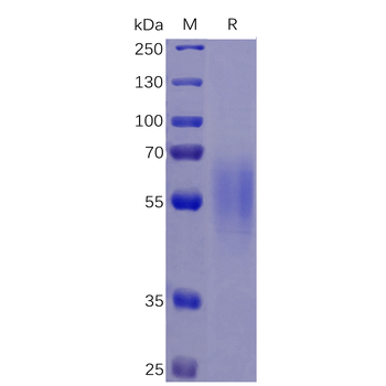 Human CD52 Protein, mFc Tag