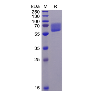 Human FCGR3A Protein (F176V), His Tag