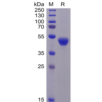 Human CEACAM5 Protein, His Tag