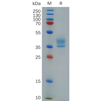 Human CD114 Protein, His Tag