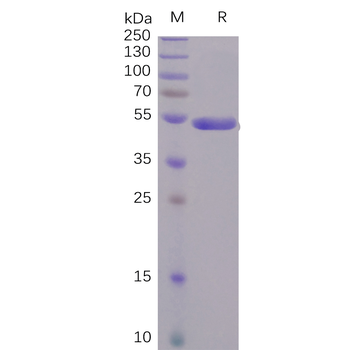 Human SIGLEC10 Protein, His Tag