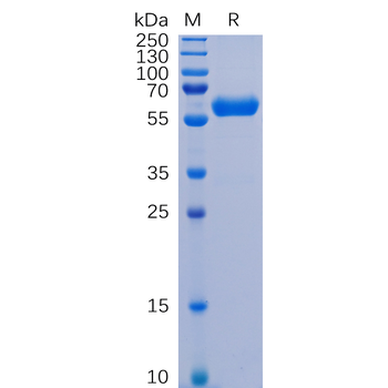 Human Her2 Protein, His Tag