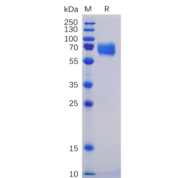 Human CLEC12A Protein, His Tag