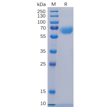 Human TIGIT Protein, hFc Tag