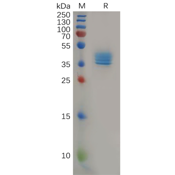 Human PD-1 Protein, hFc-His tag