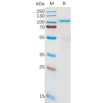Human CD48 Protein, hFc Tag