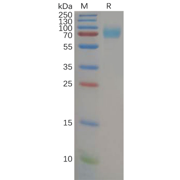 Human PD-L1 Protein, His tag