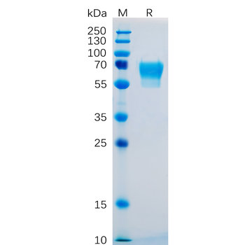 Human TNFSF11 Protein, hFc Tag