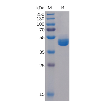 Human CSPG4 Protein, His Tag
