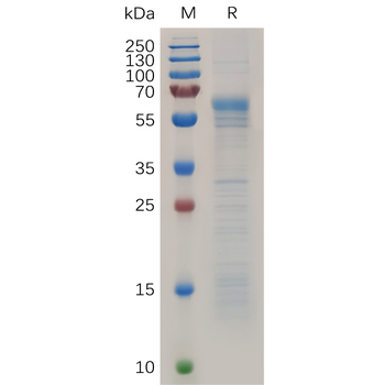 Human CD24 Protein, hFc Tag