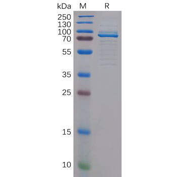 Human CD160 Protein, His Tag