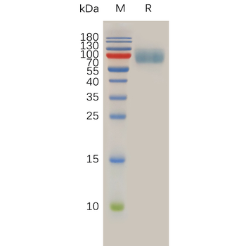 Human CD117 Protein, His Tag