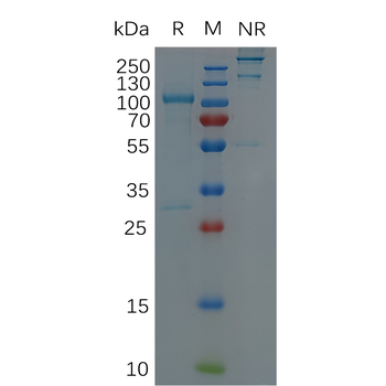 Human IL6R Protein, hFc Tag