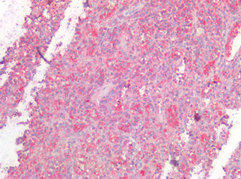 TP53/p53 Antibody
