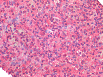 CSF1R/CD115/FMS Antibody