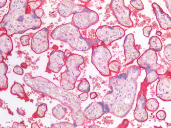 SDC1/Syndecan 1/CD138 Antibody