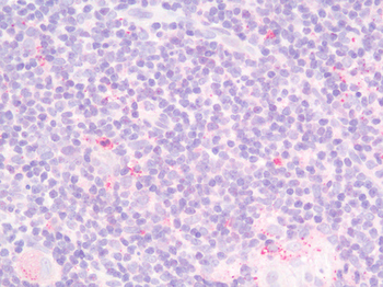 IL23A/IL-23 p19 Antibody