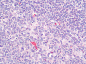 LAG3 Antibody