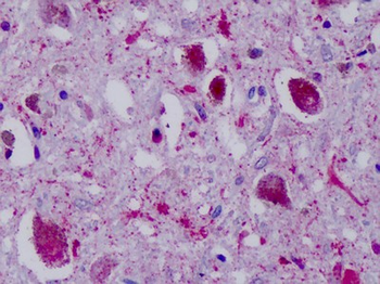 NPY4R/PPYR1 Antibody