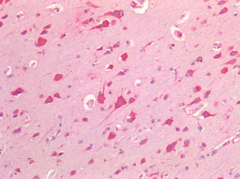 PDGFRA/PDGFR Alpha Antibody