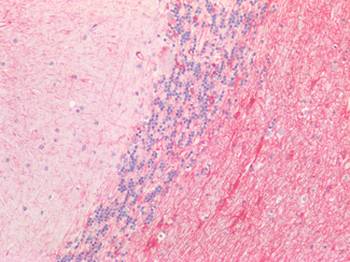 GFAP Antibody