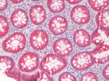KRT8/CK8/Cytokeratin 8 Antibody