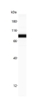 CTNNB1/Beta Catenin Antibody