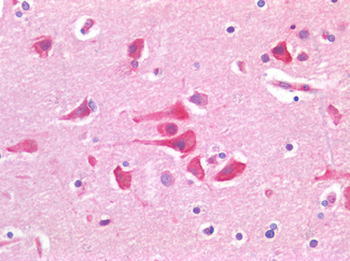 TP53/p53 Antibody