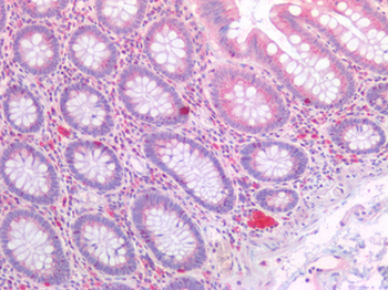 PDGFRA/PDGFR Alpha Antibody
