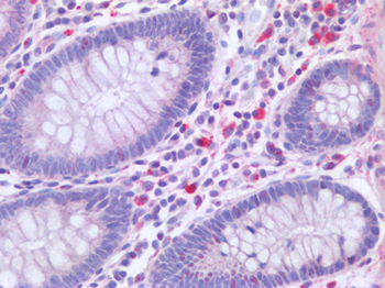 CD300A Antibody