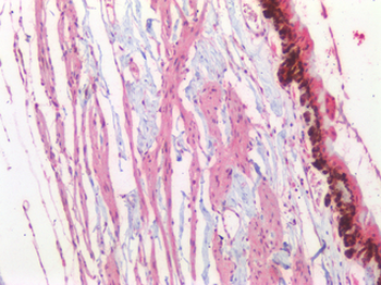 POU4F1/BRN3A Antibody