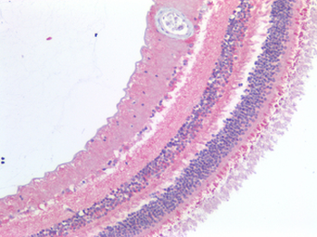 ABCA4 Antibody