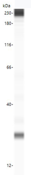 TTR/Transthyretin Antibody