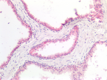 5-Alpha Reductase/SRD5A1 Antibody