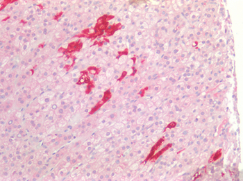 CDH3/P-Cadherin Antibody