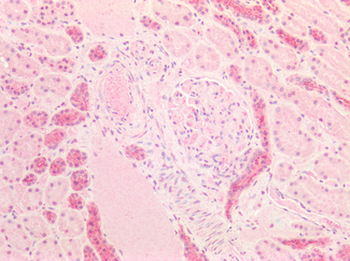 FOLR1/Folate Receptor Alpha Antibody