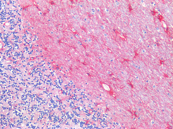 GFAP Antibody