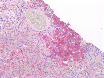 OCLN/Occludin Antibody