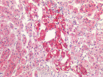 P2RX3/P2X3 Antibody