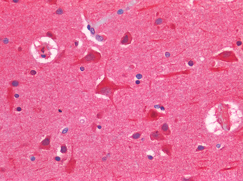 TP53/p53 Antibody