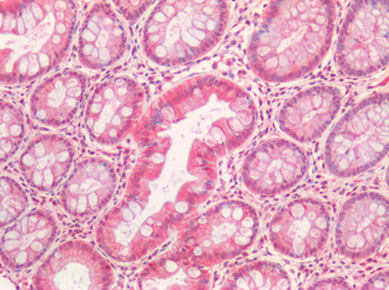 HGF/Hepatocyte Growth Factor Antibody